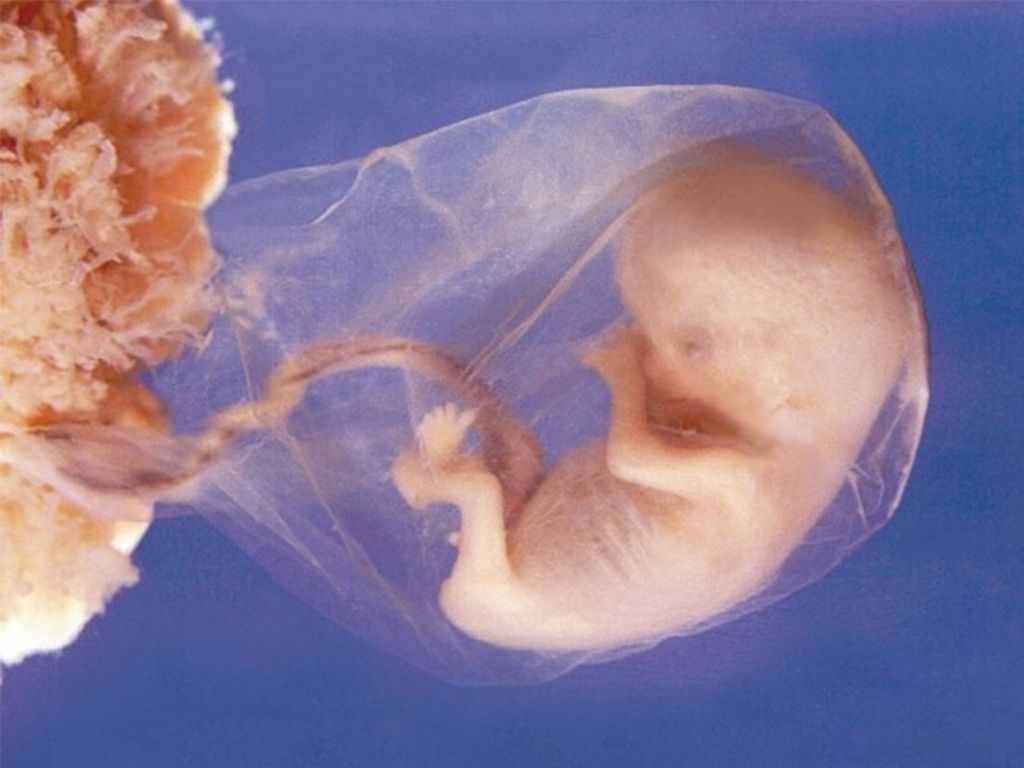 Dzień 6 "Tygodnia Modlitw o Ochronę Życia"