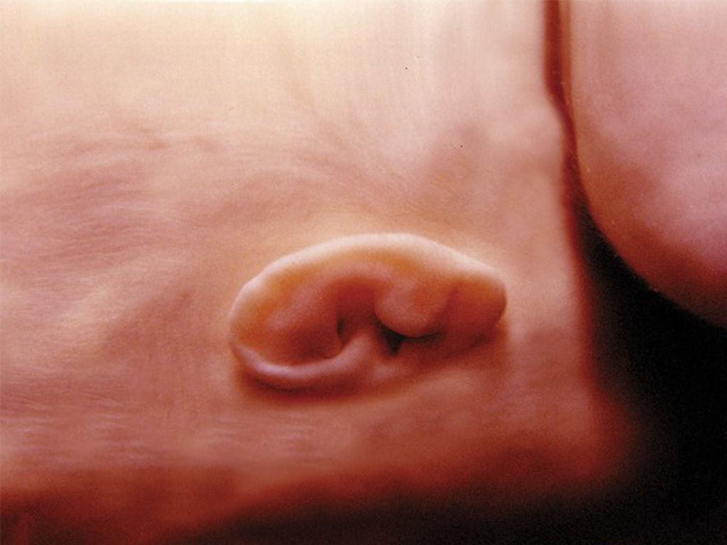 Dzień 5 "Tygodnia Modlitw o Ochronę Życia"